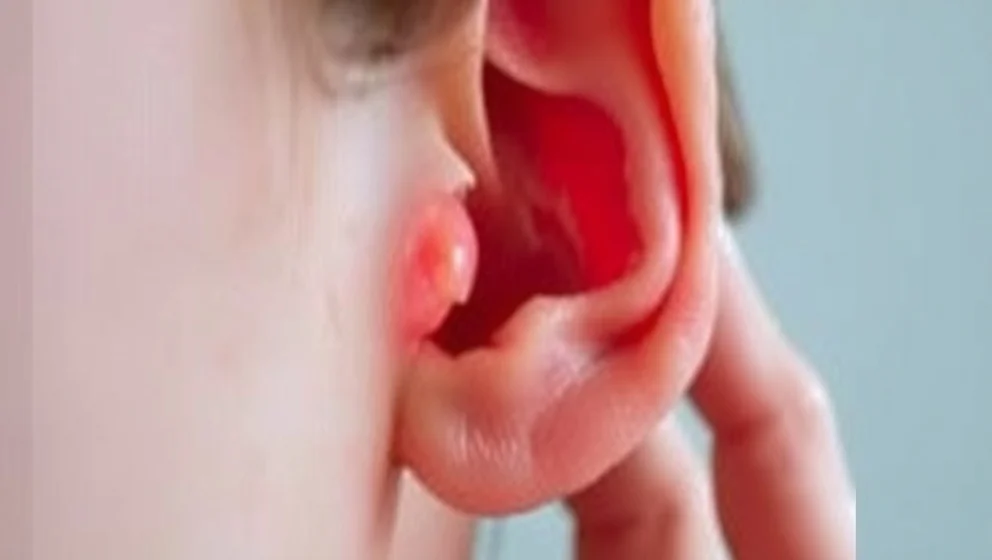 Värk i örat som kommer och går